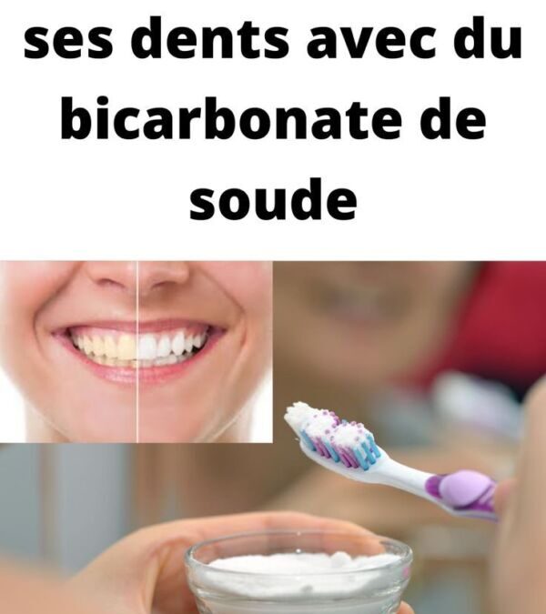 Douleur dent de sagesse : comment identifier et soulager les symptômes efficacement