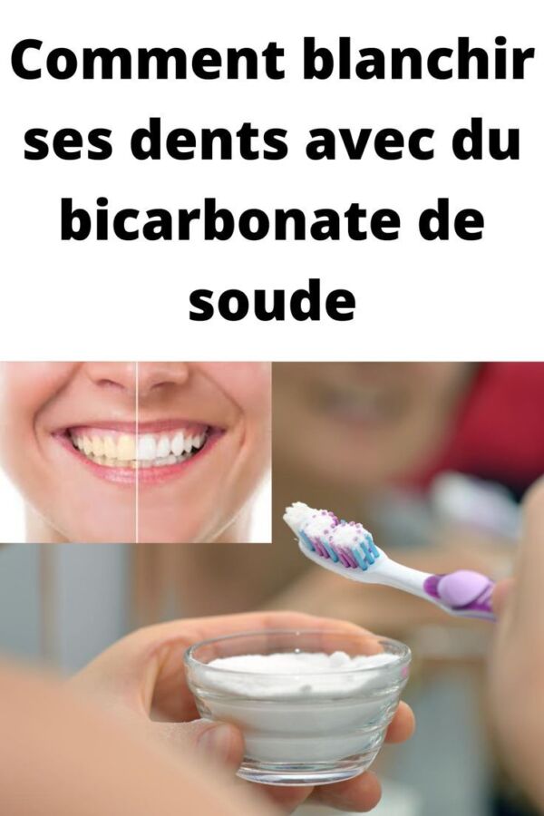 image_1773956438 symptômes de douleur dent de sagesse