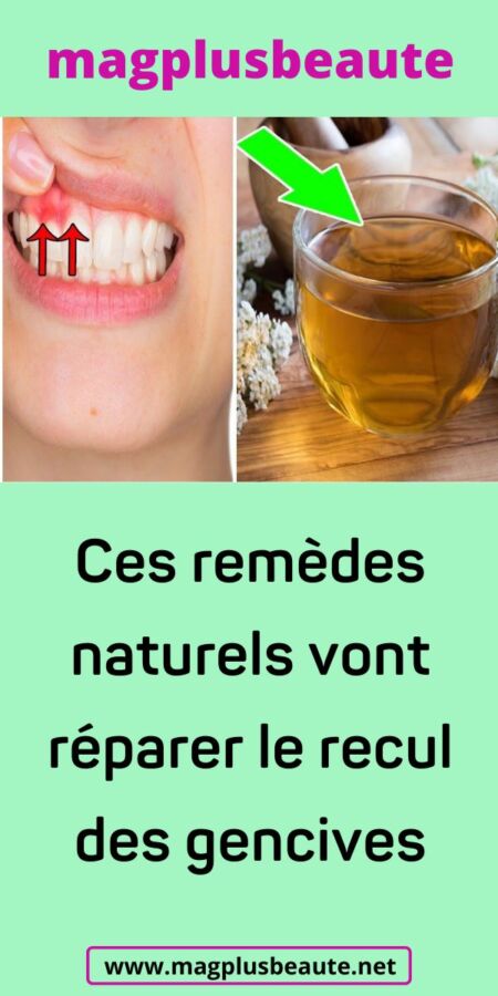 Image de clou de girofle pour soulager les douleurs dentaires