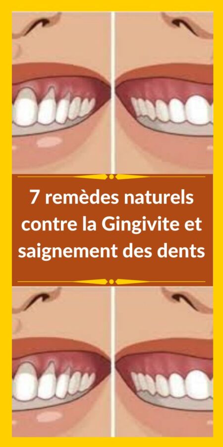 Image de clou de girofle pour soulager les douleurs dentaires