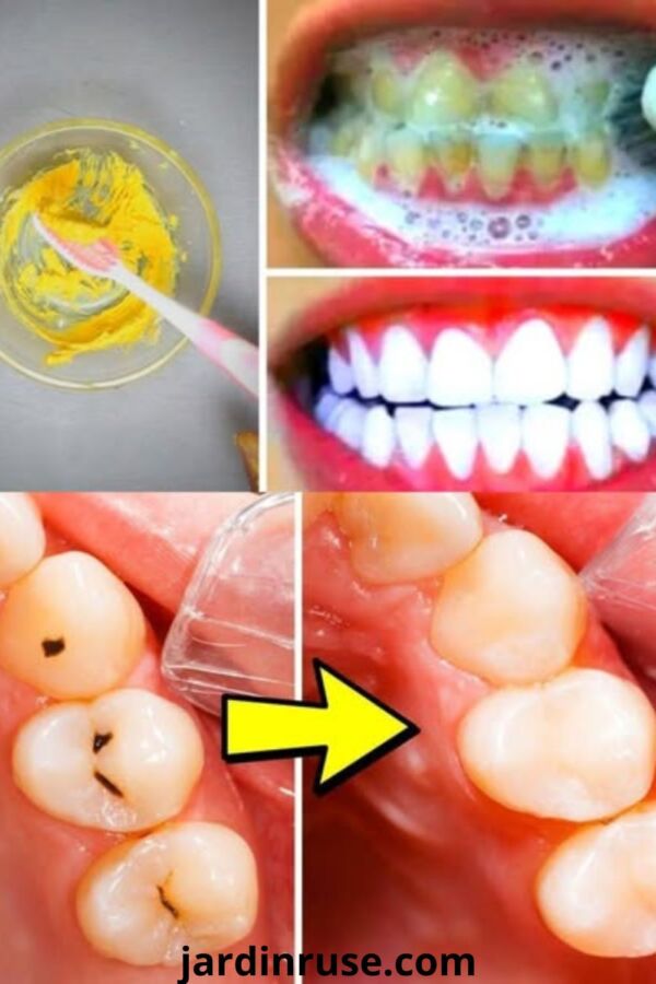 Photo de clou de girofle dent pour apaiser les maux