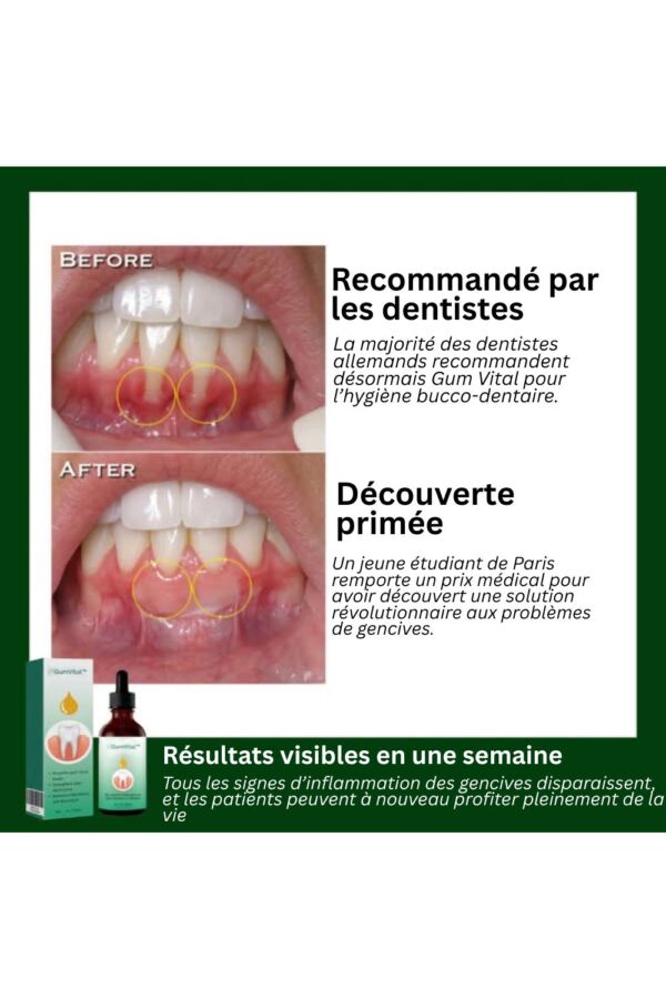 Photo de clou de girofle dent pour apaiser les maux