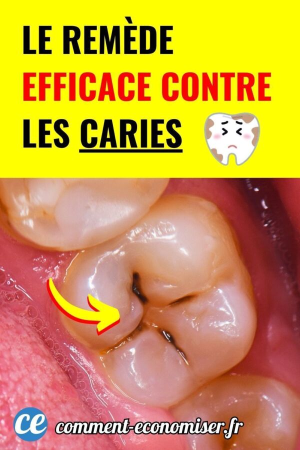 Remède douleur dentaire