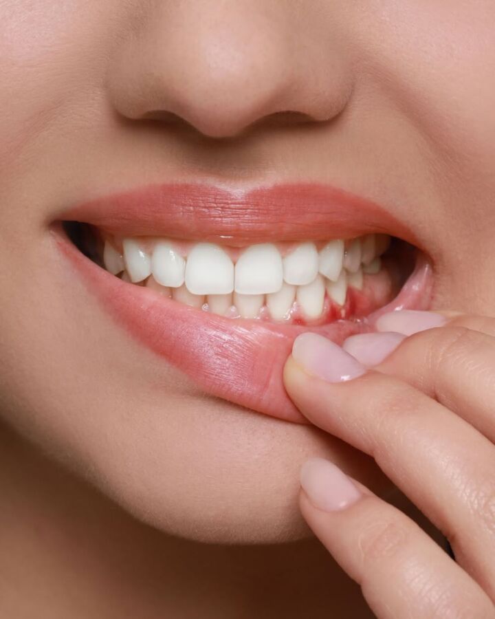 Pression dans les dents solutions