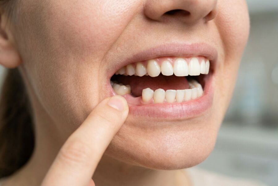 Dent douloureuse au contact