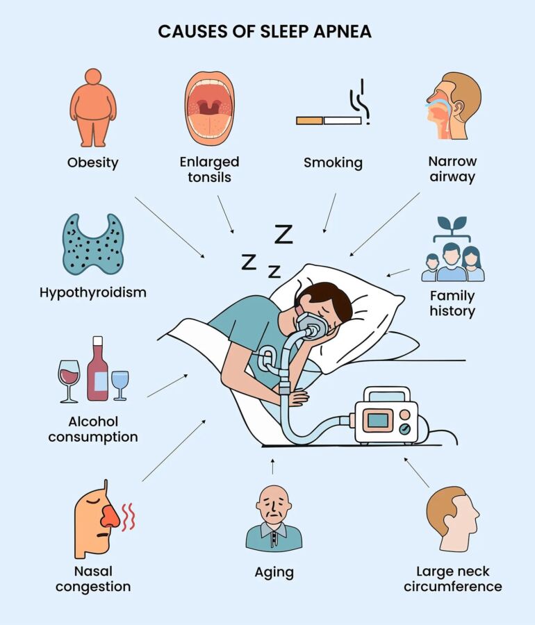 Solutions pour apnée du sommeil