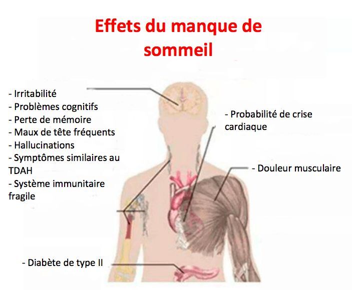 Causes privation sommeil