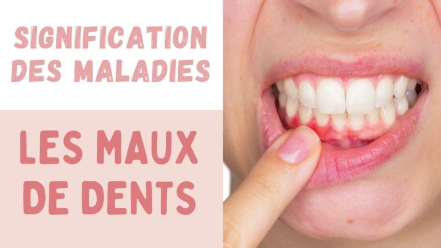 Que révèle mal de dents